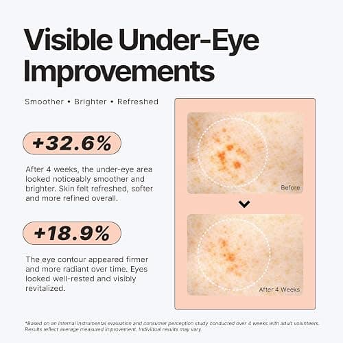 Enaskin Naturals PDRN Peptide Under Eye Patches for Dark Circles, 30 Pairs | These Under Eye Masks Help Reduce the Look of Wrinkles, Puffiness and Under Eye Bags, Leaving the Eye Area Looking Smoother thumbnail 4