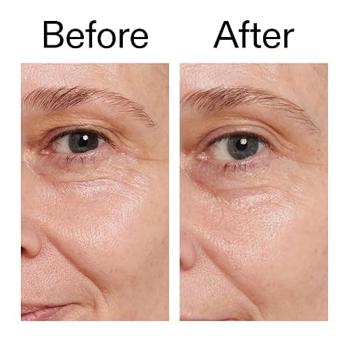 The INKEY List Retinol Eye Cream 0.5 Fl Oz, Reduce Wrinkles and Fine Lines, Night Cream, Vegan Friendly, Suitable For All Skin Types thumbnail 7