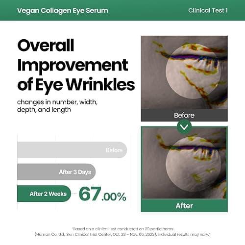 AXIS-Y Vegan Collagen Eye Serum with 2% Niacinamide, Peptides, 0.33 fl. oz. | Vegan Korean Eye Cream with Cooling Roller for Wrinkles, Fine Lines, Dark Circles, Puffiness & Deep Hydration thumbnail 5