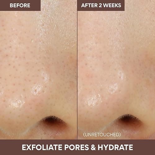 Innisfree Super Volcanic Clay Mask, Premium Korean Skincare with AHA and Natural Clusters for Deep Pore Detox, Gentle Exfoliation, Oil Control thumbnail 4