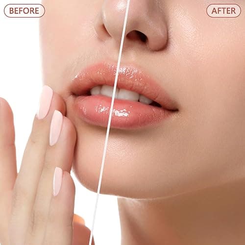 Facial Hair Remover for Women - as Seen on TV Painless Face Shaver - Electric Hair Removal Device for Face Lips Peach Fuzz with Light (White) thumbnail 3