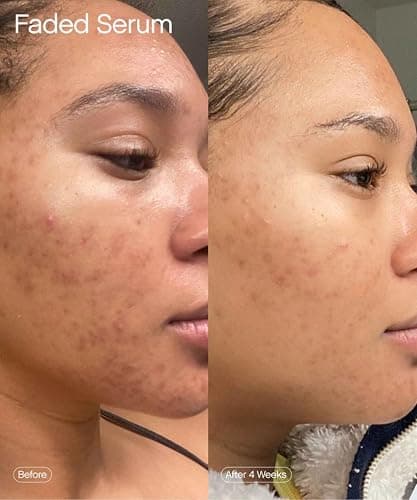 Topicals Faded Brightening and Clearing Serum | Reduces Discoloration, Post-Blemish Marks, Scars and Spots | Contains Kojic Acid and Niacinamide | Dermatologist-tested, Vegan, Cruelty-Free (1.7 Fl Oz) thumbnail 6