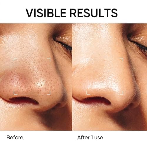 SKINTIFIC Deep Pore Cleansing Blackhead Remover Face Mask Stick, Mud Mask with Natural Alaska Volcano Clay, Gentle Exfoliating, Smoothing Skin, Non-Drying, Skincare Facial Mask thumbnail 4