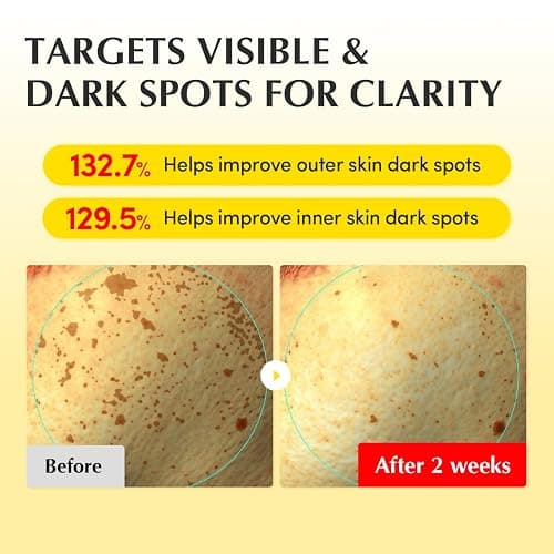 EQQUALBERRY Vitamin Illuminating Cream – Vitamin C & 5% Niacinamide + 3% TXA | Dark spots Cream | Ceramide Barrier Strength | Glowy, Lightweight Hydration | holiday gifts (1.69 fl.oz / 50ml) thumbnail 4