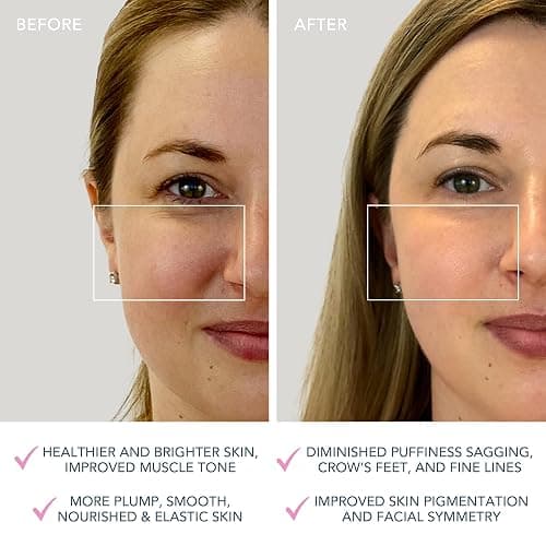 FOREO BEAR Mini Microcurrent Facial Device - Face Sculpting Tool - Firm & Contour - Reduce Double Chin - Non-Invasive - Increases Absorption of Facial Skin Care Products - Pearl Pink thumbnail 5
