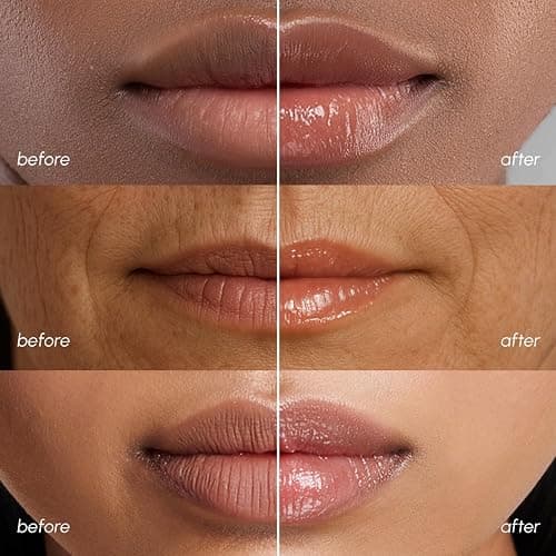 MAREE Lip Mask Overnight - Lip Moisturizer For Very Dry Lips - Hydrating Lip Butter Balm with Hyaluronic Acid & Collagen - Overnight Lip Treatment - Lip Sleeping Mask Repair - Hidratante de Labios thumbnail 5