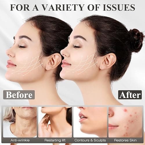 Juskaa Chin Strap for Sleeping,Double Chin Reducer,Adjustable Chin Strap,Jaw Strap,Jawline Shaper,V Line Lifting Mask,Black,M thumbnail 4