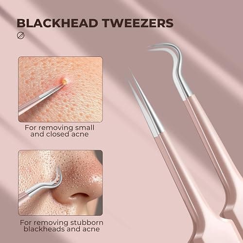 Pimple Popper Tool Kit thumbnail 2