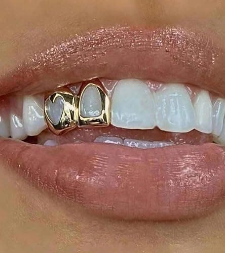 Grillz  thumbnail 2