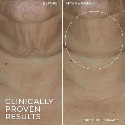 RoC Derm Correxion Retinol Firming Serum Stick with Antioxidants to Visibly Tighten and Firm Wrinkles and Laugh Lines 1.0 oz plus Retinol Eye Cream Packette thumbnail 6
