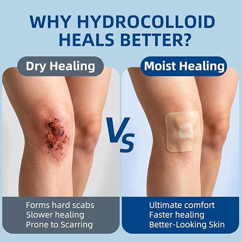 Niceful Hydrocolloid Roll for Acne Medical Grade, 2in*12ft Pimple Patch Roll, Water-Resistant Hydrocolloid Bandages for Face, Blister Bandages Highly Absorbent & Cut-to-Size thumbnail 8