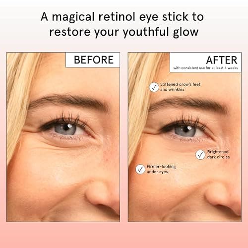 grace & stella - Retinol & Caffeine Eye Cream Stick - Under Eye Cream for Dark Circles, Anti-Aging, Puffiness, Wrinkles, Undereye Bags - Brightener with Niacinamide - Vegan Skincare (0.13 oz/3.5 g) thumbnail 3