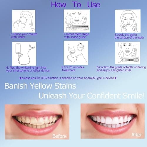 TAWEE Teeth Whitening Kit Safe for Sensitive Teeth & Enamel Wired Tooth whitening Accelerator Light with 16 Blue LED Birthday Gifts for Women Men Gum Health thumbnail 5