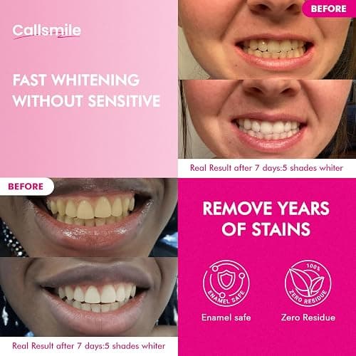 CALLSMILE Teeth Whitening Strips - Whitening Strips for Sensitive Teeth, Hydrogen Peroxide Teeth Whitener for Coffee, Wine, Tobacco, and Other Stains, 28 Strips (14 Days Treatment), Mint thumbnail 2