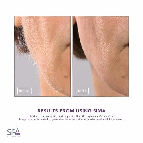 SPA SCIENCES - SIMA Patented Dermaplane Razor for Women Face – Painless 2-in-1 Facial Exfoliation & Peach Fuzz Hair Removal – Anti-Aging – 3 Speeds – Rechargeable – 7 Weeks Treatment thumbnail 5