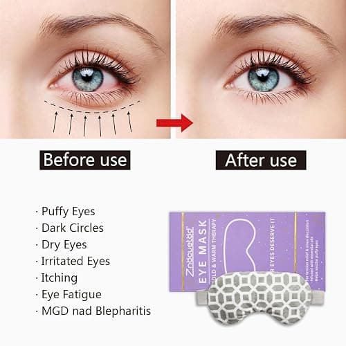 2 in 1 Heated/Ice Eye Mask Moist Heat Eye Mask Lavender & Flaxseed Sinus Pillow Microwavable for Dry Eye,Styes,Sinus Pain,Headache,Migraine,Puffy or Swollen Eyes Irritated and Inflamed Eyelid Bumps thumbnail 3