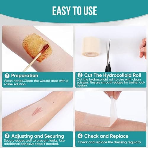 Hydrocolloid Roll for Wound Care, Hydrocolloid Patch Bandages with Self-Adhesive, Bed Sore Bandages, Highly Absorbent for Burn, Blister, Acne Care, Sterile and Waterproof (2in x 12ft) thumbnail 8