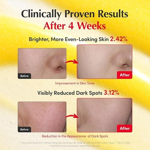 EQQUALBERRY Vitamin Illuminating Serum | Niacinamide 4% & TXA | Brightening Vitamin C Serum for Face Glow with Hyaluronic Acid | Dark Spot & Uneven Tone Care | Korean Skincare, 1.01 fl oz thumbnail 4