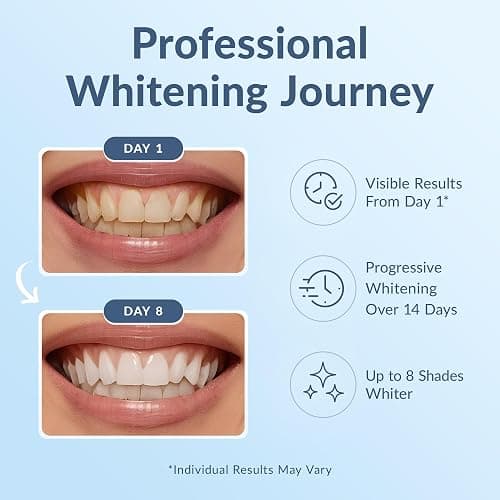 DRDENT Professional Teeth Whitening Strips - Pack of 44 Strip - 22 Treatments Kit - Safe for Enamel - Non Sensitive Teeth Whitening - Whitening Without Any Harm + Mouth Opener Included - 1 Count (Pack of 44) thumbnail 3