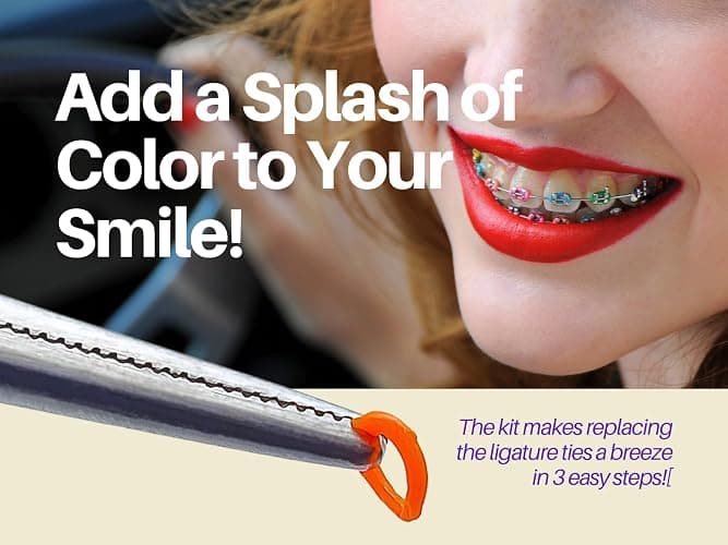 ARTMAN INSTRUMENTS Dental Braces Color Changing Kit, Orthodontic Ties Changing kit, Change The Color of Your Braces Yourself in Minutes Ligas para Brackets Ortodoncia thumbnail 2