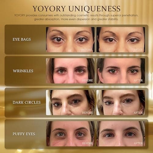 YOYORY Hydrogel Eye Patches for Dark Circles, Puffy Eyes & Wrinkles - Collagen & Hyaluronic Acid Infused Under Eye Masks, Hydrating Firming Care, Fine Lines,Eye Bags Reduction (60 Pcs) Gold thumbnail 2