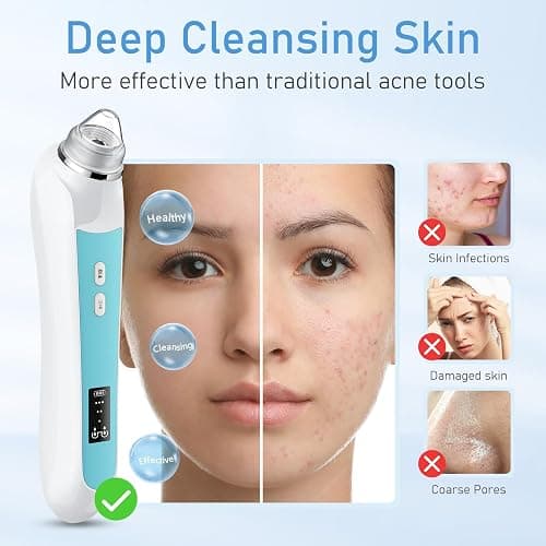 Facial Pore Blackhead Remover Vacuum, 1080P Camera Blackhead Remover, 20x Zoom, 8 LEDs ＆ 3 Suction Modes, 800mAh Battery & USB - 6 Heads Pore Cleaner Kit for Women&Men(Blue) thumbnail 3