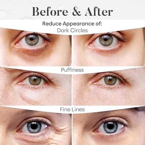 BLOOMORA Variety Under Eye Patches (30 Pairs) - Dark Circles & Puffy Eyes Care - Eye Care Mask for Refreshment - 5 Varieties thumbnail 4