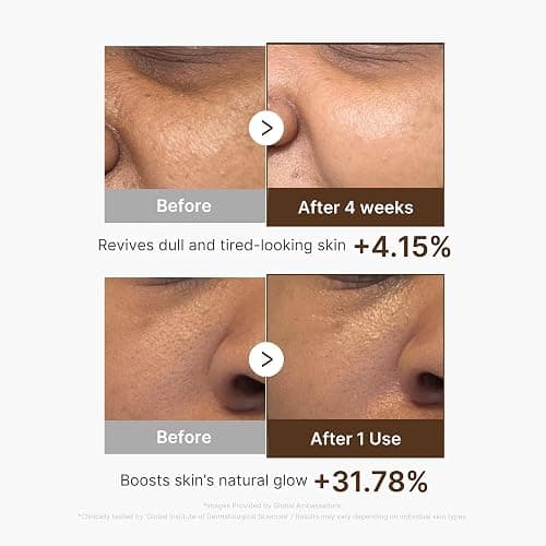 medicube Deep Vita C Capsule Serum & Cream Duo: Liposome Vita C Capsule Serum and Vita C Capsule Cream | Hydrating Vitamin C Capusle for Dull, Uneven-Looking Skin thumbnail 4