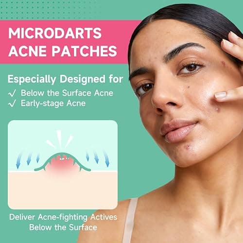 TEAWOO 36-Count Microdart Acne Patches, Hydrocolloid Pimple Patches with Salicylic Acid & Madecossoside, Microdart Zit Patches for Deep Blemishes & Early Stage Acne (Patented) thumbnail 2