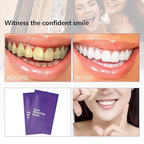 Gentle Daily Purple Teeth Whitening Strips – Enamel-Friendly, No Peroxide Formula for Sensitive Teeth, Reduce Surface Coffee & Tea Stains, Portable Teeth Care for Home & Travel (14 Strips) thumbnail 3