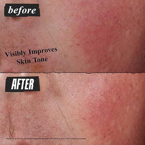 Kiehl's Ultra Facial Advanced Repair Barrier Cream, Intensive Treatment Relieves Dry + Sensitive Skin, Rapidly Reduces Redness and Soothes, Fast-Absorbing Breathable Formula, Paraben-Free - 1.7 fl oz thumbnail 4