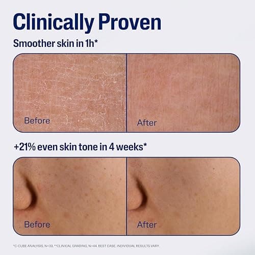CETAPHIL Repair & Renew Night Serum for Stressed Sensitive Skin with Gallic Acid & Vitamin E, PM Face Serum, Repairs Skin Barrier Overnight, Dermatologist Recommended, 1 fl oz Dropper Bottle thumbnail 5