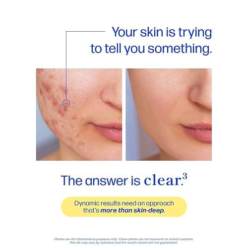 Clear Skin Supplement with Zinc, DIM & Probiotics | 3-in-1 Balance, Glow & Health Skin Support | Triple Action Hyaluronic Acid, Niaciminide & Vitamins for Hormone, Complexion & Gut Support | 60 Ct thumbnail 3