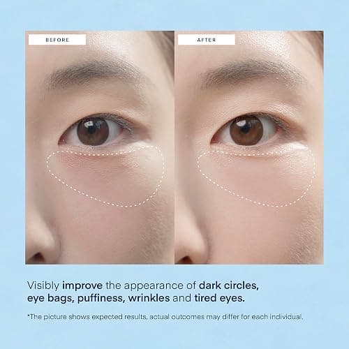 Under Eye Patches thumbnail 4
