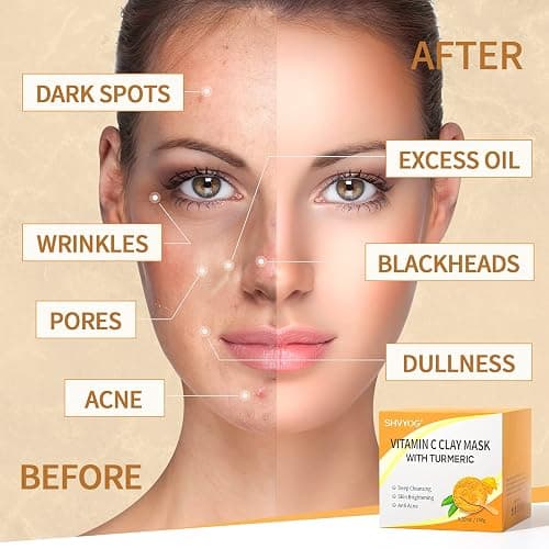 SHVYOG Vitamin C Face Mask with Kaolin Clay and Turmeric for Dark Spots, Dull Skin, Skincare Facial Mask for Controlling Oil and Refining Pores 5.29 Oz thumbnail 6