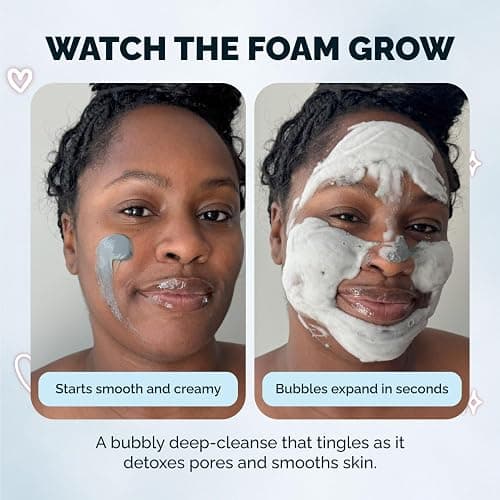 Elizabeth Mott Carbonated Bubble Detox Clay Mask – Korean Skincare for Deep Pore Cleansing, Acne, Blackheads & Oil Control – Charcoal Face Mask for Breakouts & Smooth Skin – Cruelty-Free, 3.53 oz thumbnail 5