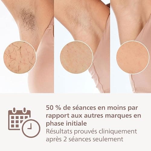 Philips Lumea série 8000, Épilateur à lumière pulsée, alternative à l'épilation laser, technologie SenseIQ, 4 accessoires pour le corps, le visage, le maillot et les aisselles, modèle BRI948/00 thumbnail 2