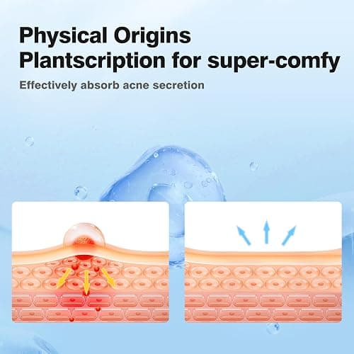 QUSTERE Pimple Patches for Face, Hydrocolloid Acne Patches, Cute Star Zit Covers, Colorful Spot Stickers with Tea Tree, Salicylic Acid & Cica Oil| 3 Sizes (10mm, 12mm & 14mm) |200 Count thumbnail 5