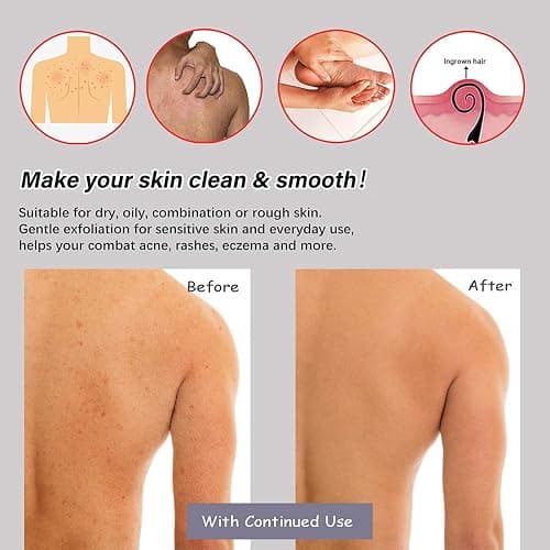 Gant de Douche Exfoliante Gant Corps a Gommage Gants de Bain LOT de 6 (Colore- 3 paires) thumbnail 2
