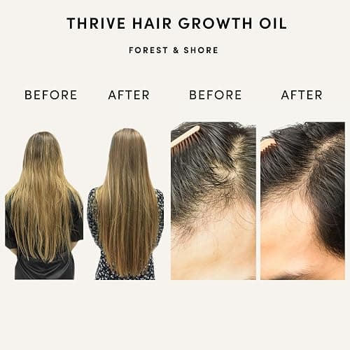 Forest & Shore Hair Growth Oil, 100% Natural, with Caffeine, Biotin, Castor , Argan & Rosemary, Effective Serum for Damaged Hair thumbnail 2