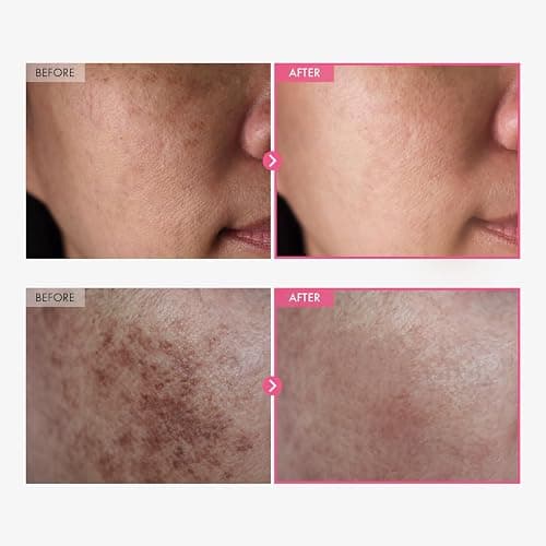 TOSOWOONG Arbutin 7% + Tranexamic Acid 4% Cream for Dark Spots, Brightening | 70,000ppm Arbutin + 40,000ppm TXA, Niacinamide, Glutathione for Blemishes & Freckles, Glow, Korean Skincare, 50ml/1.69 fl oz thumbnail 2