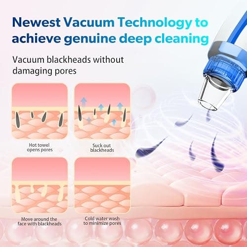 Blackhead Remover Pore Vacuum Upgraded Facial Pore Cleaner Electric Comedone Whitehead Extractor Tool-5 Suction Power,5 Probes,USB Rechargeable thumbnail 5