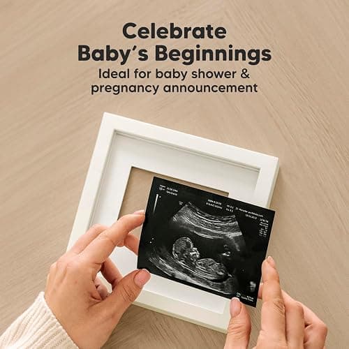 KeaBabies Baby Sonogram Picture Frame - Modern Ultrasound Picture Frames for Mom to Be, First Pregnancy Gifts for Expecting Mom & First Time Dad, Baby Gender Reveal Gifts (Alpine White) thumbnail 6