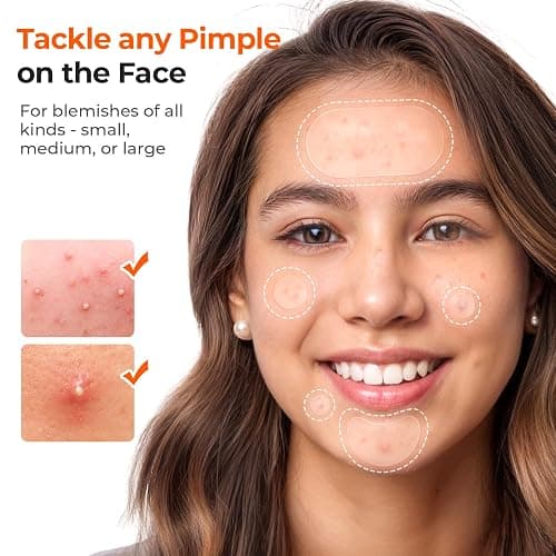 TKTK 443 Count Pimple Patches for Face, Hydrocolloid Acne Cover Patch Bulk | Pimple Stickers for Cheeks, Forehead, Chin Blemishes Zit & Breakouts, All Skin Types, Dots, Strips, Contoured 5 Sizes Variety thumbnail 3
