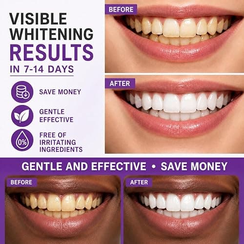 Purple Teeth Whitening Strips – V34 Color Correction, Teeth Whitening Strips for Brighter Smile, Helps Neutralize Yellow Tones, Gentle Whitening for Sensitive Teeth, 28 Strips (14 Treatments) thumbnail 3