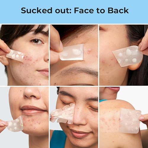TKTK Hydrocolloid Pimple Patches All-in-One Combo Pack (9 Sizes 801 Count) | 7 Shapes Bulk Strips for Face & Back, Gentle Blemish Care for Acne, Zit Covering Set for Breakouts & All Skin Types thumbnail 7