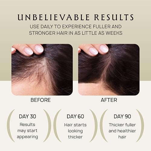 Lebanta Hair Growth Oil Spray - 100% Pure Ingredients For Non Greasy, Thicker & Stronger Hair - Organic Batana, Castor, Biotin, Saw Palmetto, and Rosemary Oil Gifts for Men & Women Scalp - 4.1 Fl Oz thumbnail 4