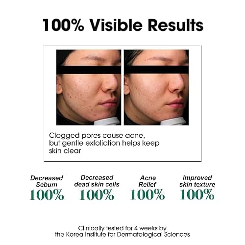 SOME BY MI AHA BHA PHA 30 Days Miracle Toner – 5.07oz, 150ml – Korean Salicylic Acid Exfoliating Face Toner for All Skin Types – Daily Pore Care & Oil Control with 2% Niacinamide – Korean Skin Care thumbnail 4