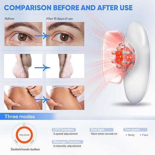 Ciyada 3-in-1 Body Sculpting Machine, 3-in-1 Electric Cellulite Massager-3 Modes Adjustable Body Sculpting Machine- Home Use Cupping Therapy Tool for Back, Belly, Waist, Arms, Legs - White thumbnail 3