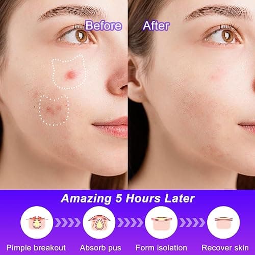 CELECARE,Pimple Patches,Acne Patches,Pimple Patches for Face, Cute Stickers,Salicylic Acid & Tea Tree, 120 Hydrocolloid Dots in 20 Colors for Face,Cute Cat Pimple Stickers thumbnail 5